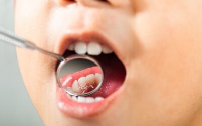 Salud dental infantil